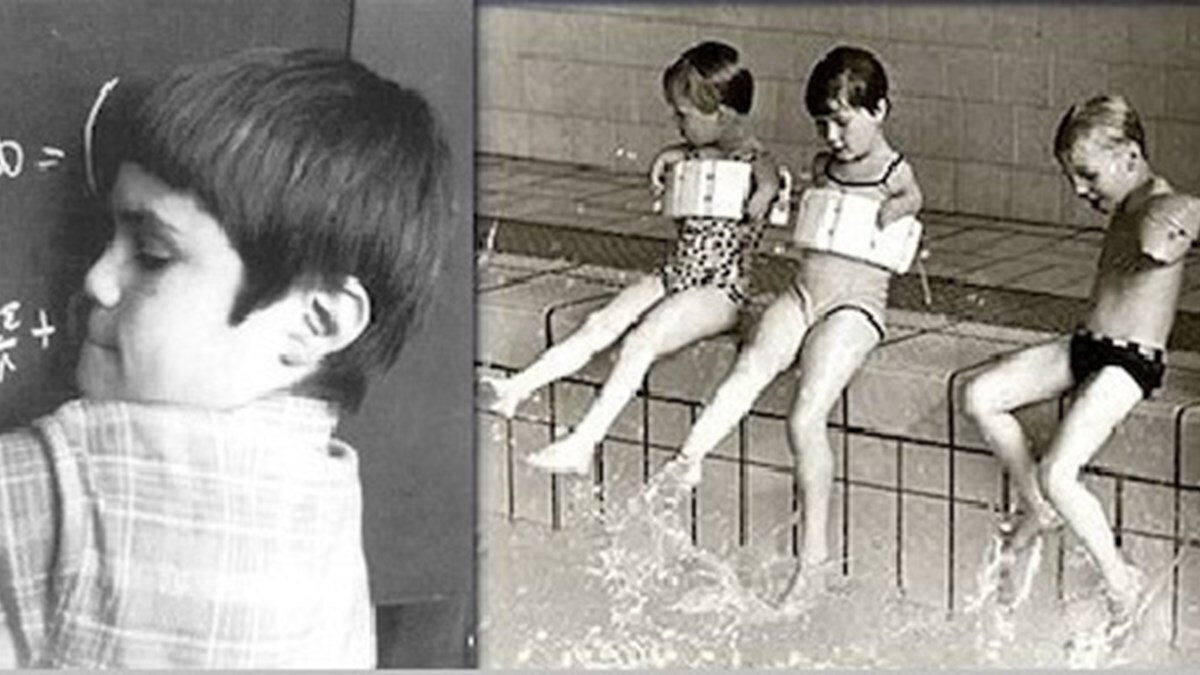 Жертвы талидомид / Фото: Others