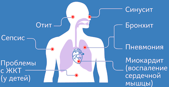 Основные системы и органы, которые поражает вирус. Фото из интернета: https://admin.cgon.ru 