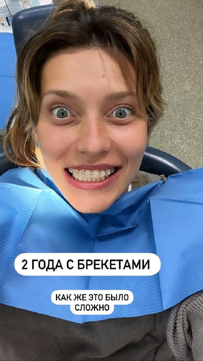    Регина призналась, что ей было сложно носить брекетыСоцсети Регины Тодоренко