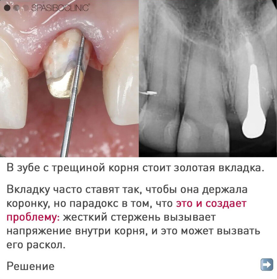 можно делать минет после удаления зуба фото 54