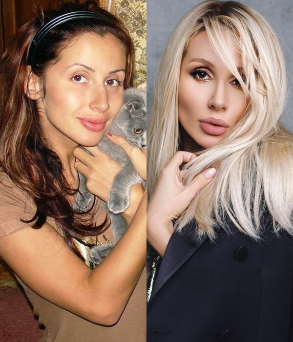 Светлана до и после пластики