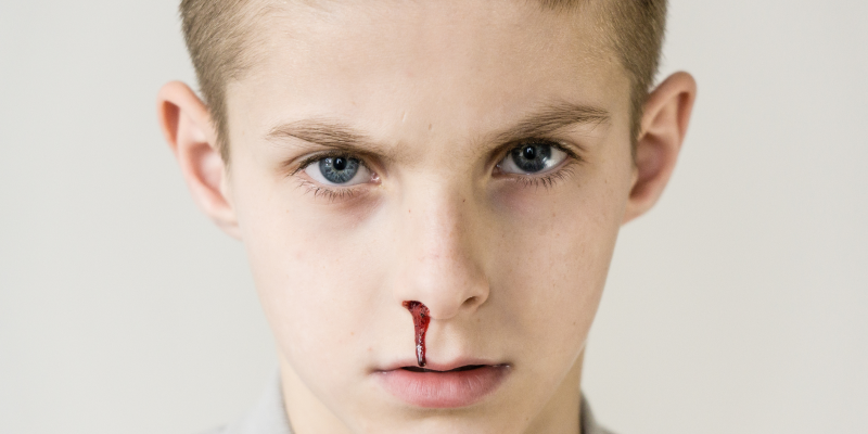 Появление носового кровотечения у ребёнка может указывать на различные проблемы со здоровьем