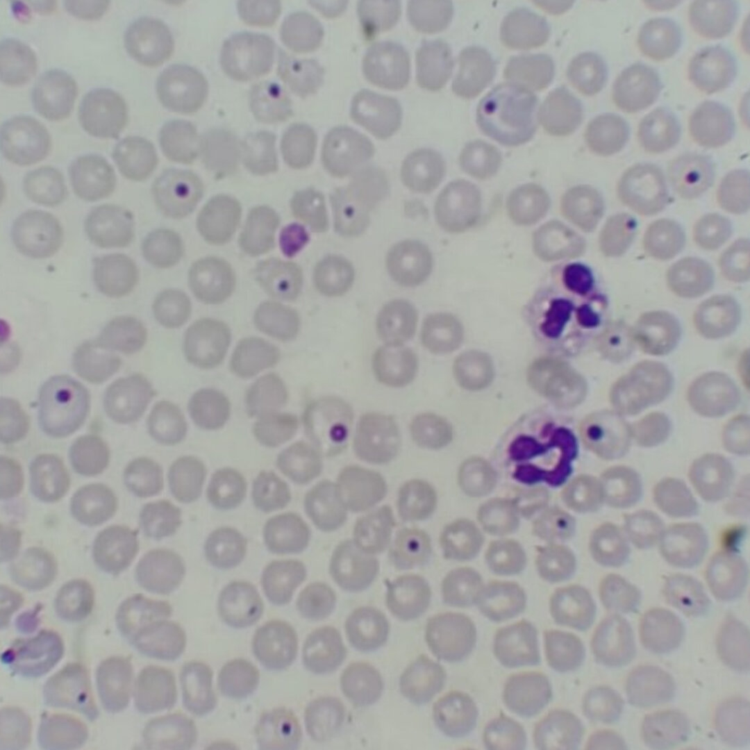 (Canine distemper virus, CDV) 