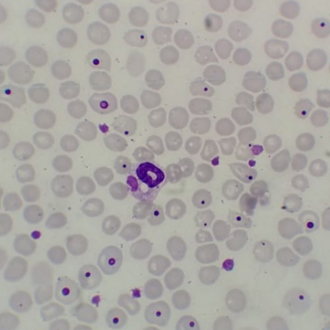 Canine distemper virus, CDV