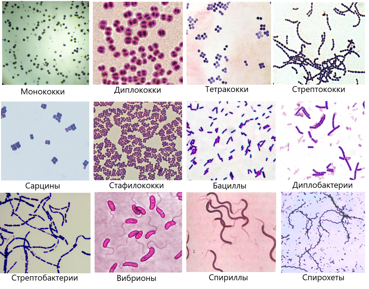 Формы бактерий | Биология - наука о жизни | Дзен