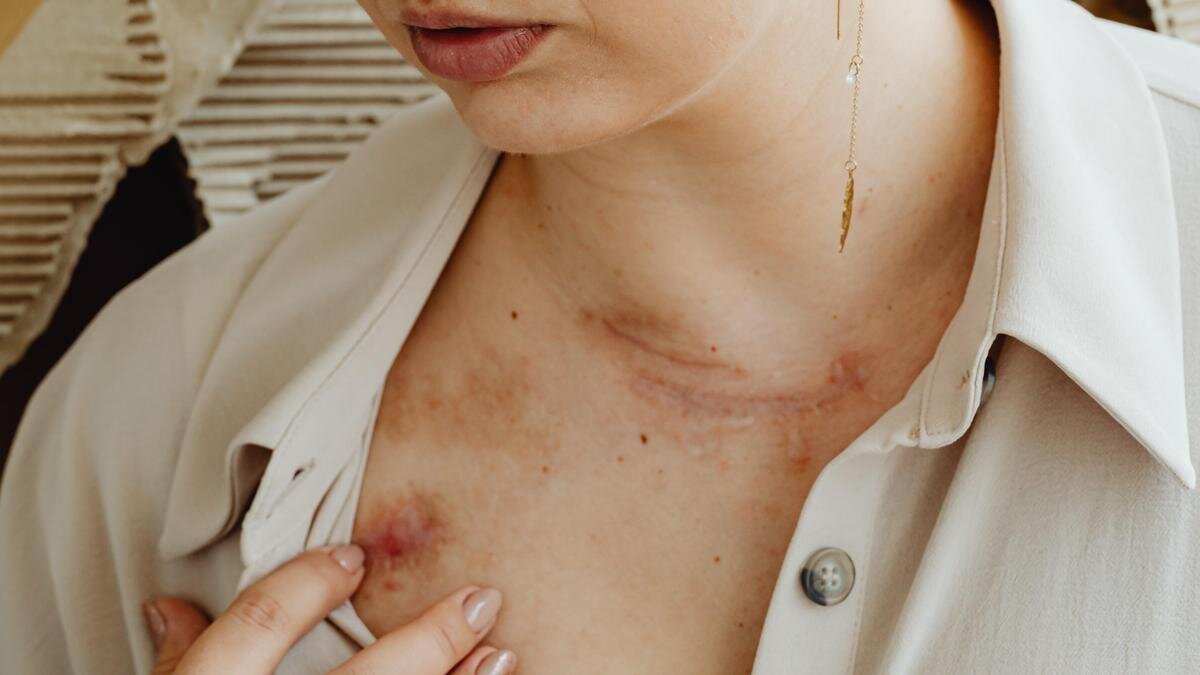    Женщина с синяками на теле:pexels.com