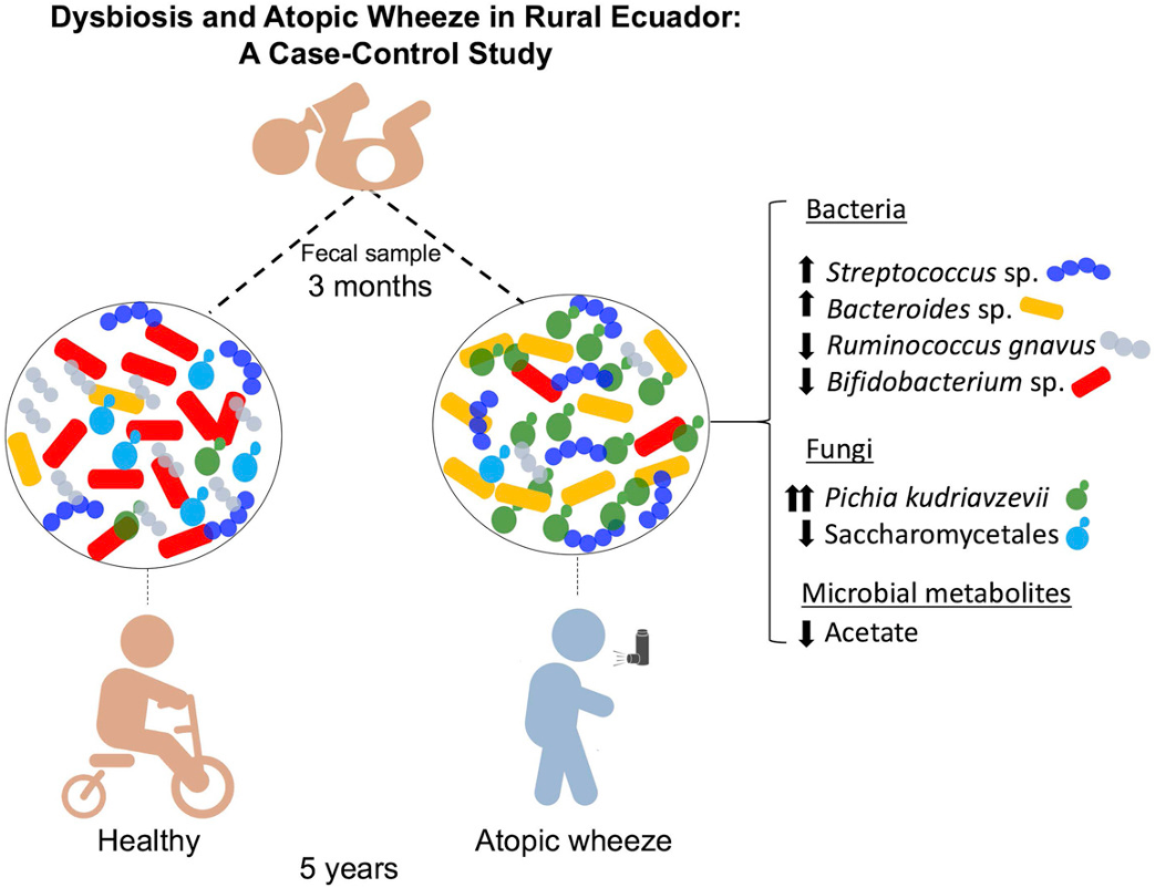 Пример одного такого исследования (дети Эквадора). Младенцы 3 мес с 2 типами микробиоты. Один развивает атопические хрипы в 5 лет, другой нет. Бактерии и Грибы очень важны, а еще наличие ацетата, как вы можете заметить, его недостаточно. Arrieta, 2018