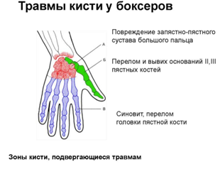 Кисть руки представляет собой сложную многофункциональную структуру.-2
