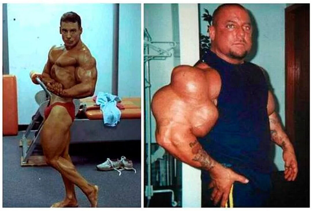 грег валентино бицепс. грег валентино. синтоловый фрик грег валентино. грег валентино в молодости. грег валентино бицепс 71 см.