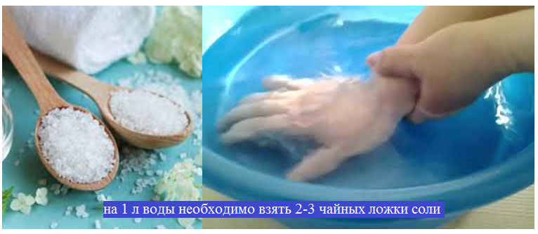 Ванночки с морской солью. Ванночки с морской солью после перелома. Солевые ванночки для кисти руки. Ванночки с морской солью для рук после перелома.