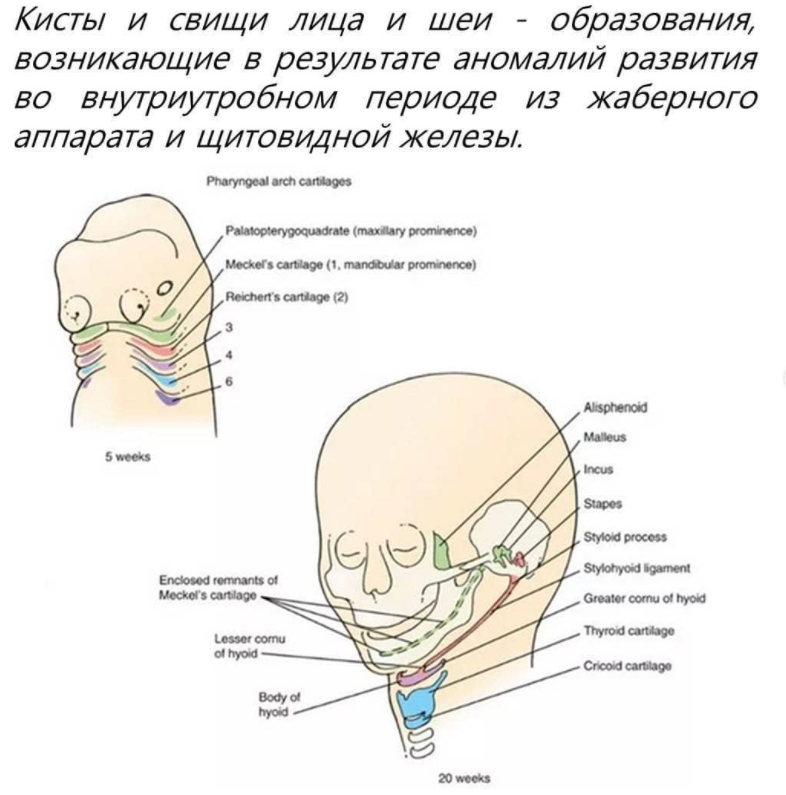 Лечение врожденных кист и свищей лица и шеи