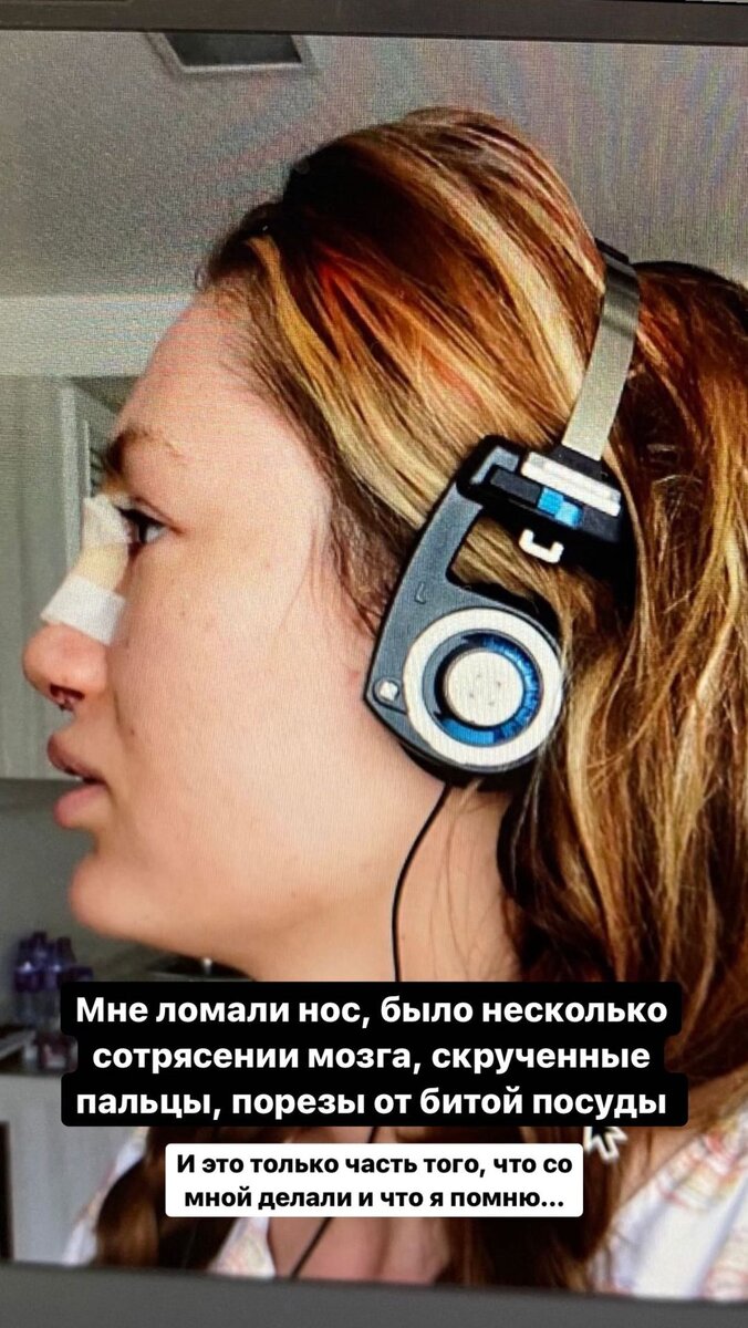    Алена показала жуткий снимокСоцсети Алены Ашмариной