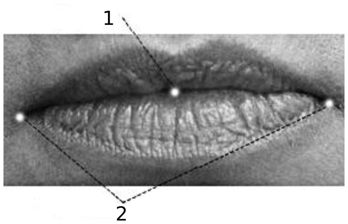 Губы в расслабленном состоянии в норме.