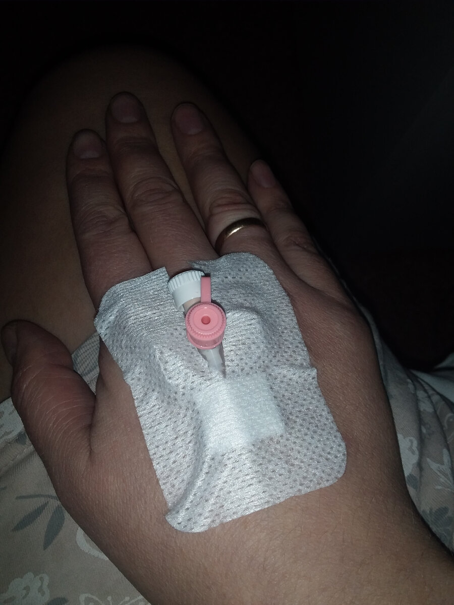 Это катетер. Странно, что не сняли. Поди опять будут мучить капельницами и уколами завтра. Рука выглядит лет на 50)))) (Личное фото)