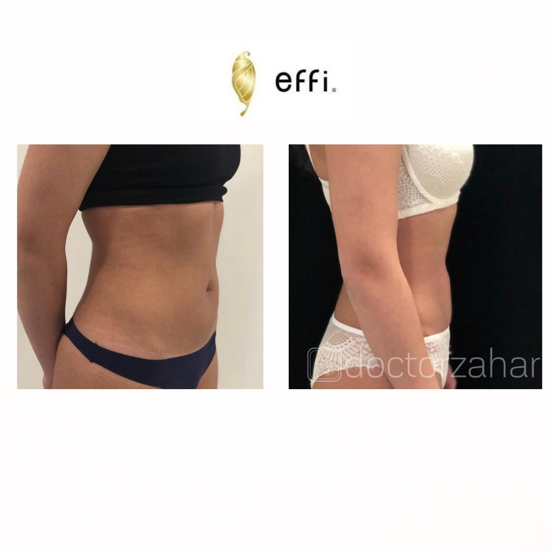 Пластический хирург — Захаров Сергей Яковлевич