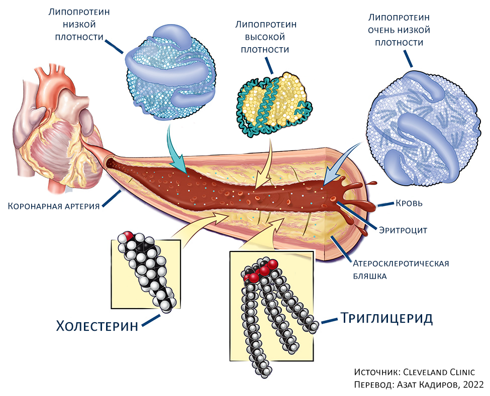 Липиды разных фракций в крови и кровеносный сосуд с атеросклеротическими бляшками