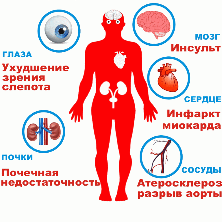 Низкое давление - серьезная причина задуматься о лечении | Клиника ...