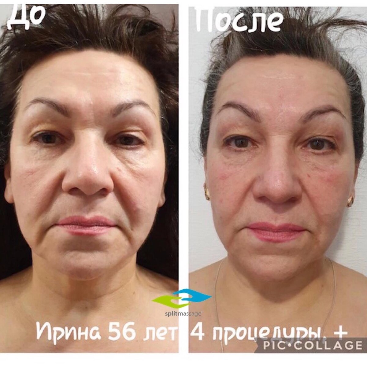 #Сплитмассаж 