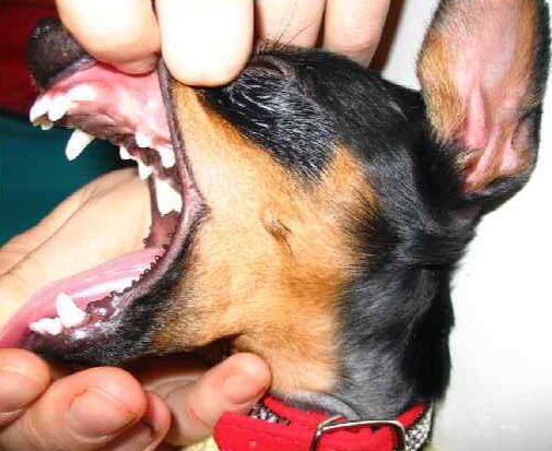 Неправильный прикус с недостающими зубами