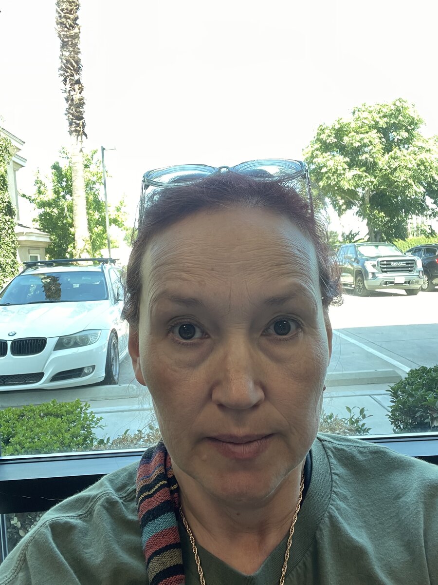 Видок ещё тот🤣 Особенно синяки под глазами радуют 