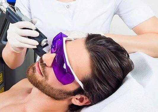 Лазерная эпиляция для мужчин на лице в москве