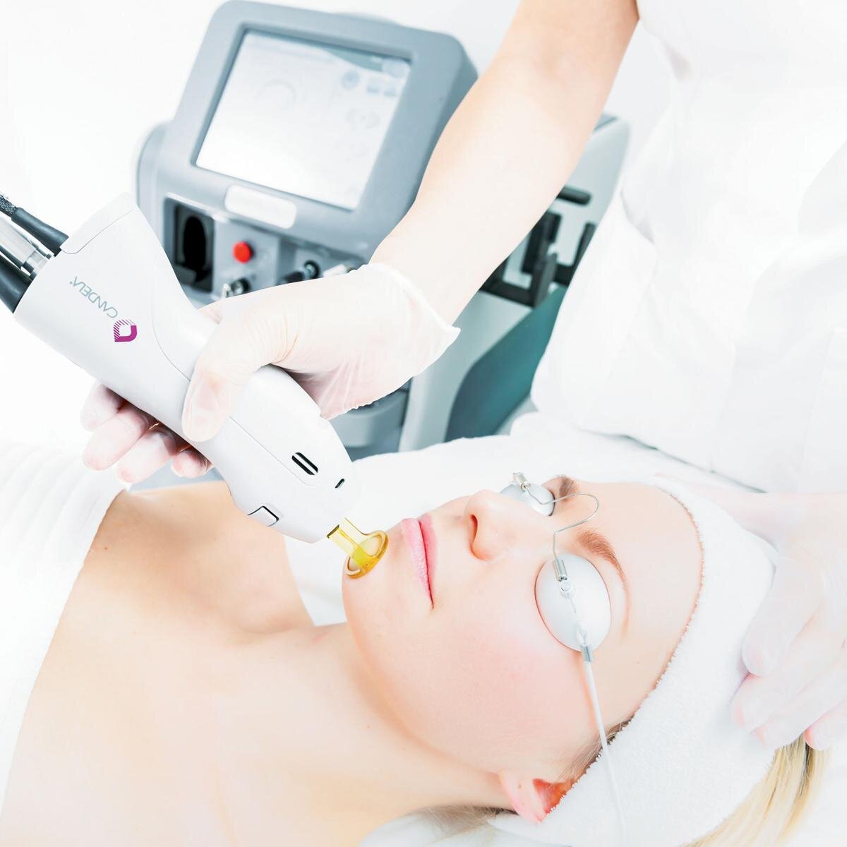 Лазер для женщин. Candela GENTLELASE Pro Alexandrite Laser hair removal. Лазер Candela GENTLELASE Pro. Candela GENTLELASE Pro-u.