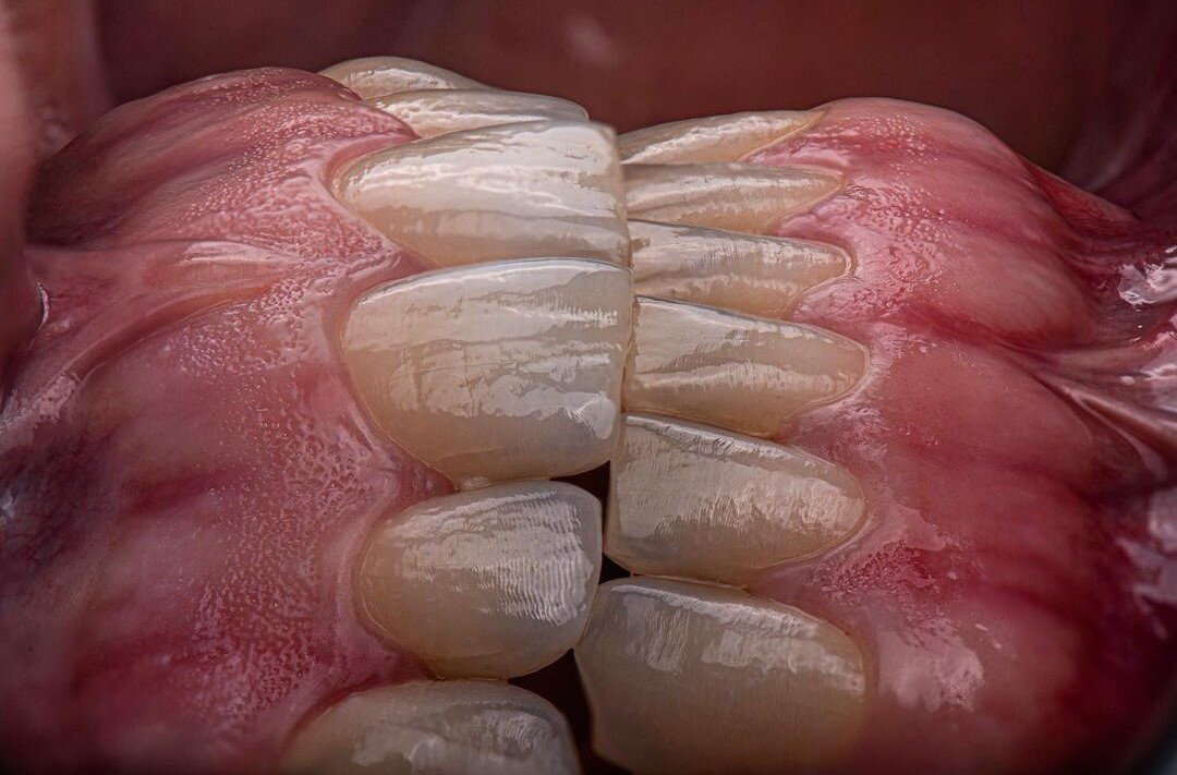 Просто красивая фотография сделанная моим врачом