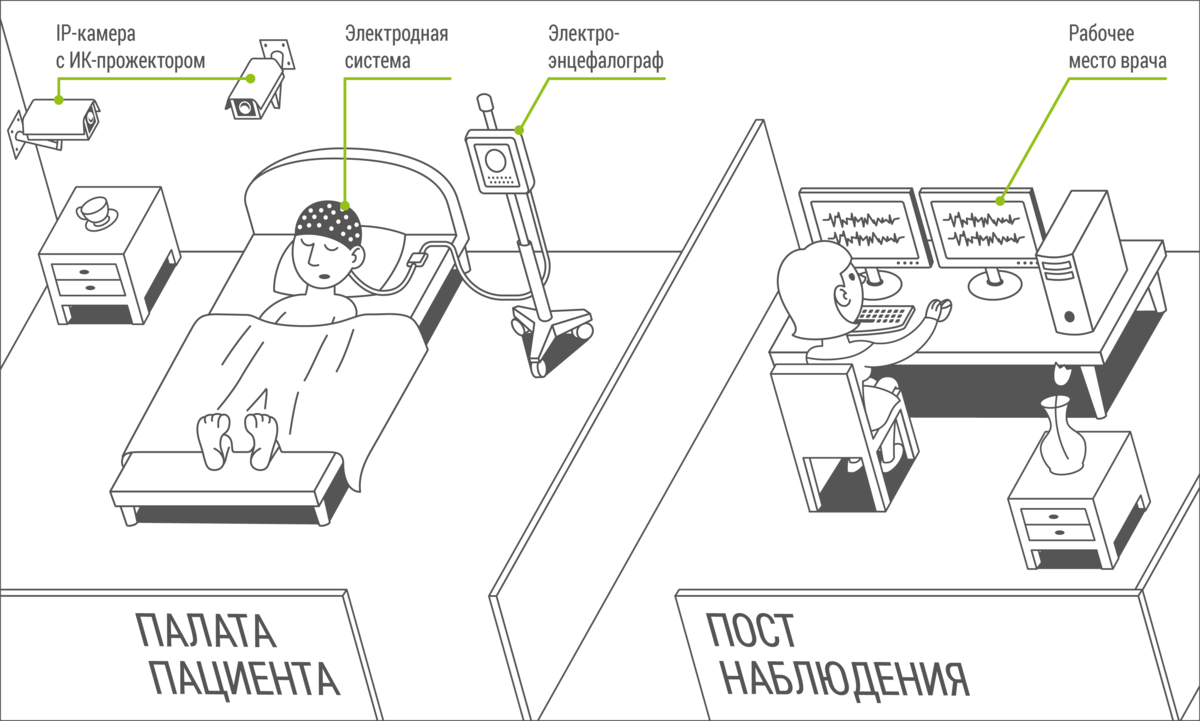 Причины развития эпилепсии