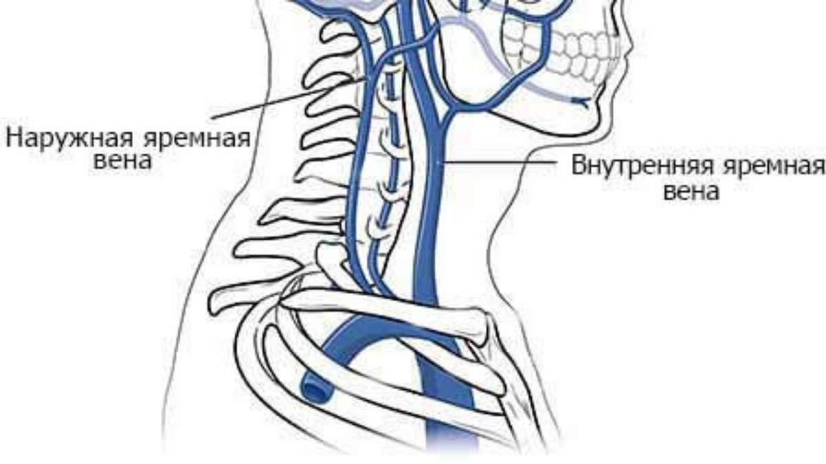 Лечение нарушения венозного оттока от головы в медицинском центре 