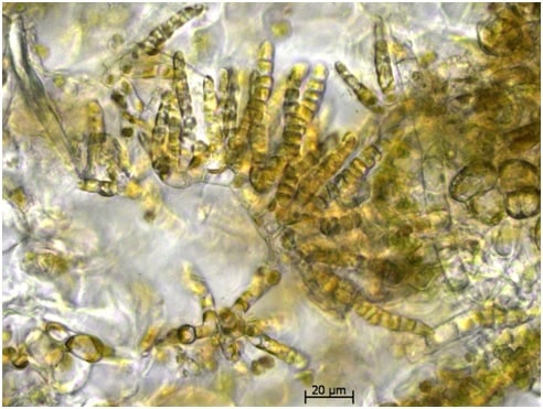 Фото микроскопии водорослей Streblonema sp. Растут на поверхности водоросли-хозяина Undaria pinnatifida.