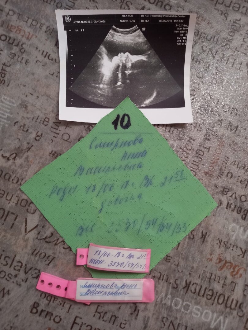 А это дочери