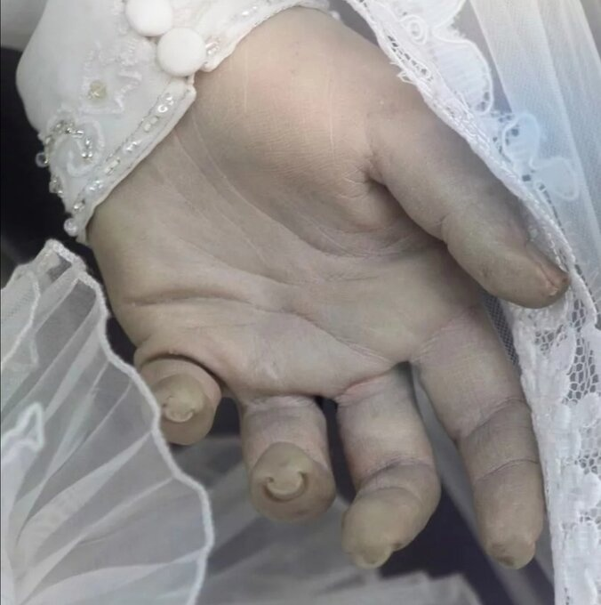 Рука Паскуалиты. ttps://vk.com/hirokristall?z=photo-122866040_457289468%2Fwall-122866040_193148