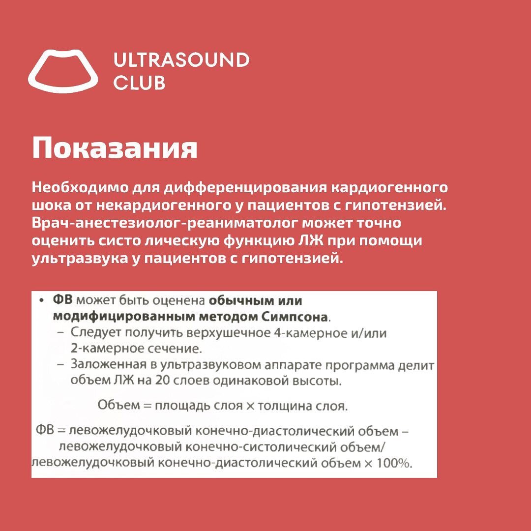 УЗИ польза: Оценка систолической функции левого желудочка ✔️ | Ultrasound  Club - сообщество врачей УЗД | Дзен