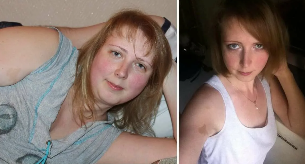 Похудевшие на дюкане фото до и после. Дюкан диета до и после. Диета Дюкана до и после фото. Диета Дюкана фото.