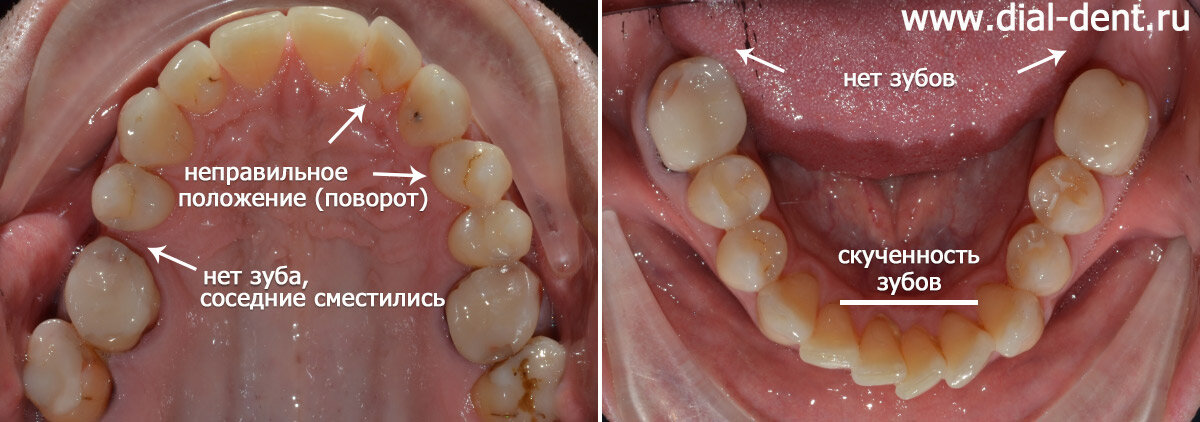 проблемы, выявленные на консультации