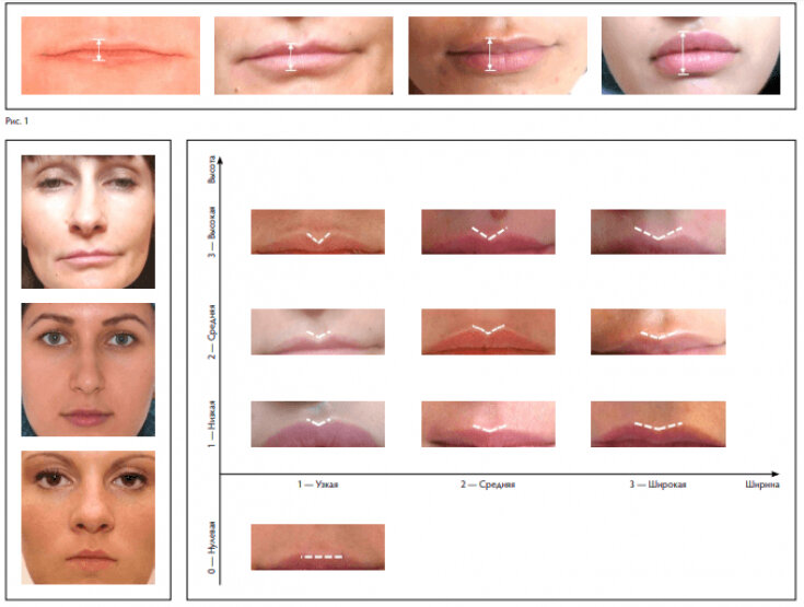 Формы половых губ у девушек персик щавель. Формы губ. Идеальная форма губ. Форма губ для увеличения.