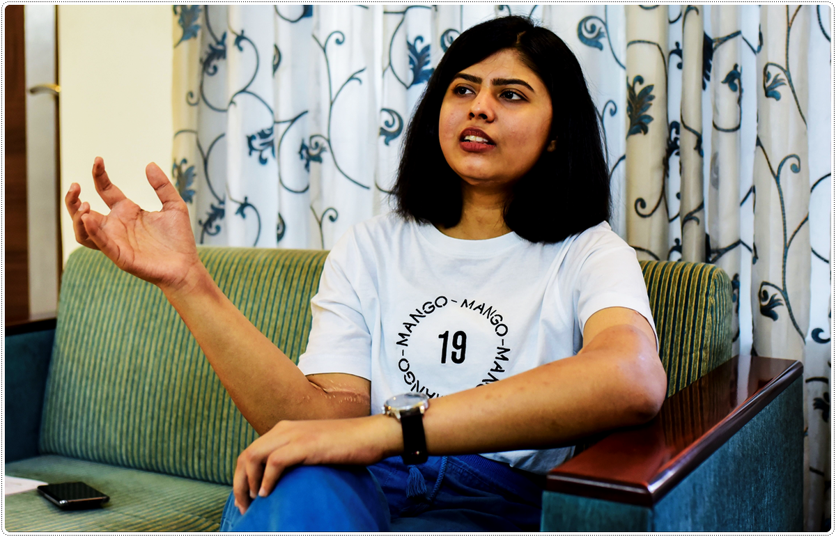    Шрея после пересадки рук                                                                                 https://yandex.ru/images/