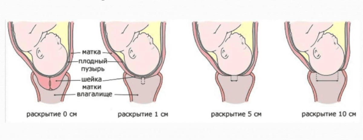 Процесс родов делится на три периода: