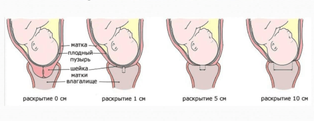 Что поможет в родах