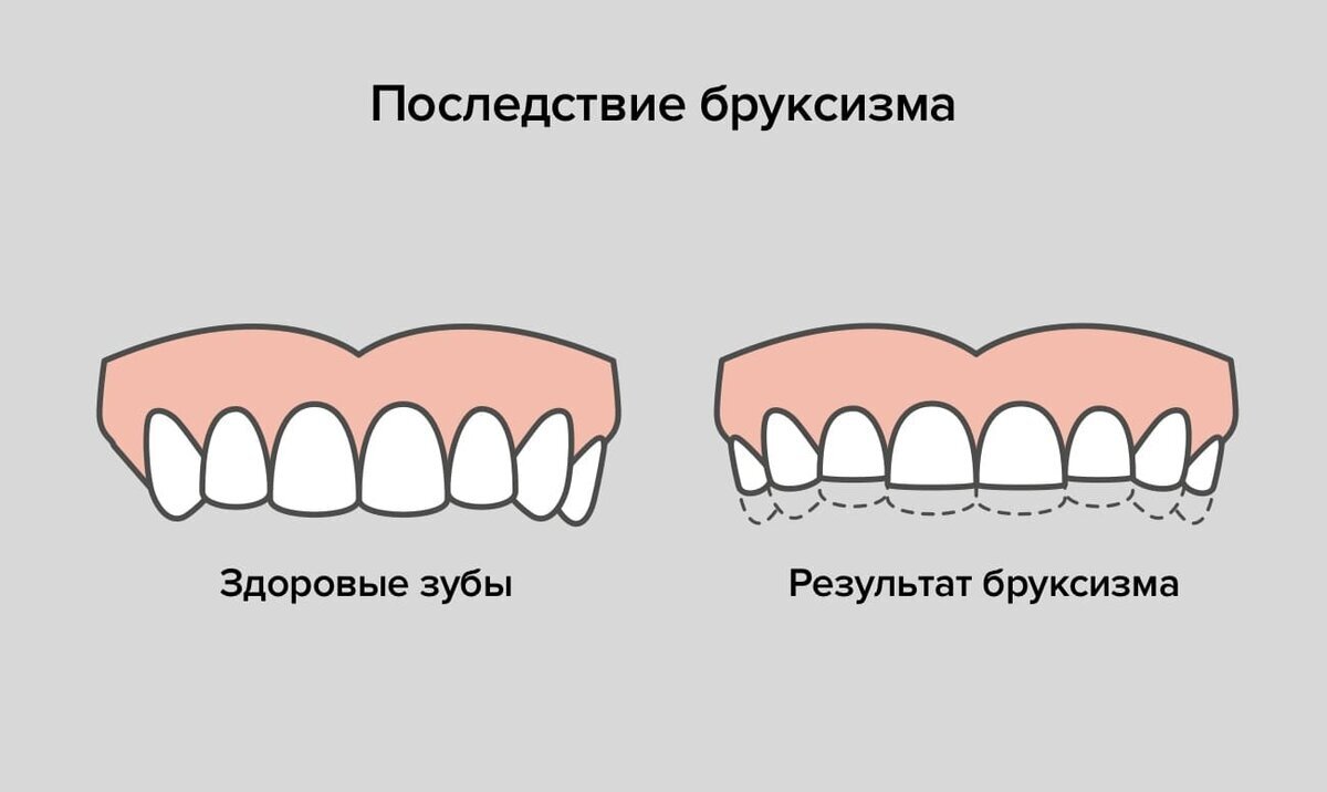 У моего сына это уже есть.