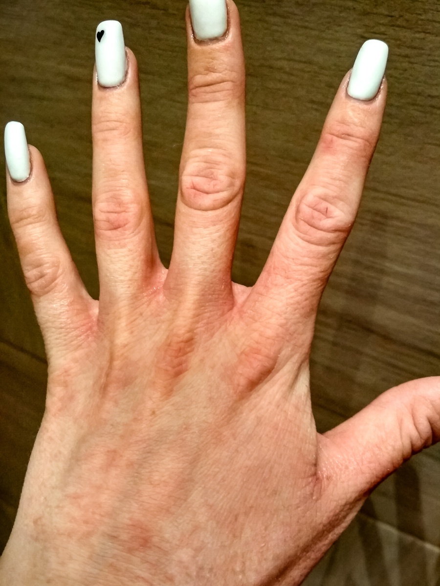 Состояние кожи рук до нанесения бальзама в роли ночной маски