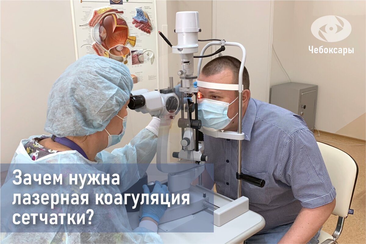микрохирургия глаза чебоксары. лазерная коррекция зрения ульяновск. офтальмолог. периферическая лазеркоагуляция сетчатки глаза. лазерная чебоксары.
