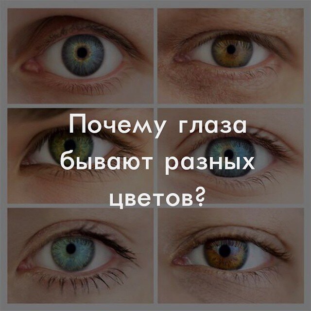 Цвет глаза зависит от пигмента. Бывают разные глаза. Цитаты про разный цвет глаз.