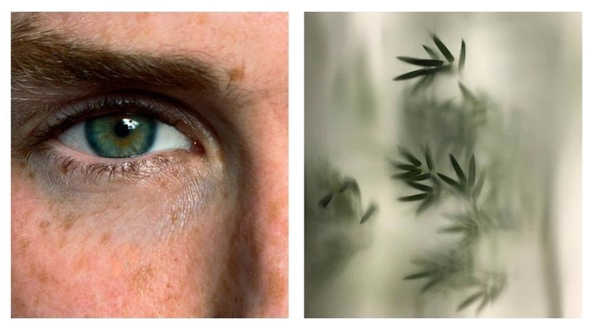 Что такое фотостарение?