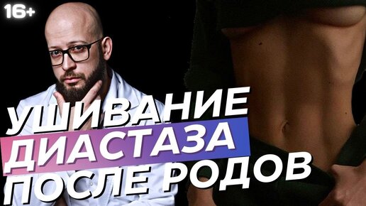 Как ушивают диастаз после родов_ Операция по ушиванию диастаза после беременности. Абдоминопластика