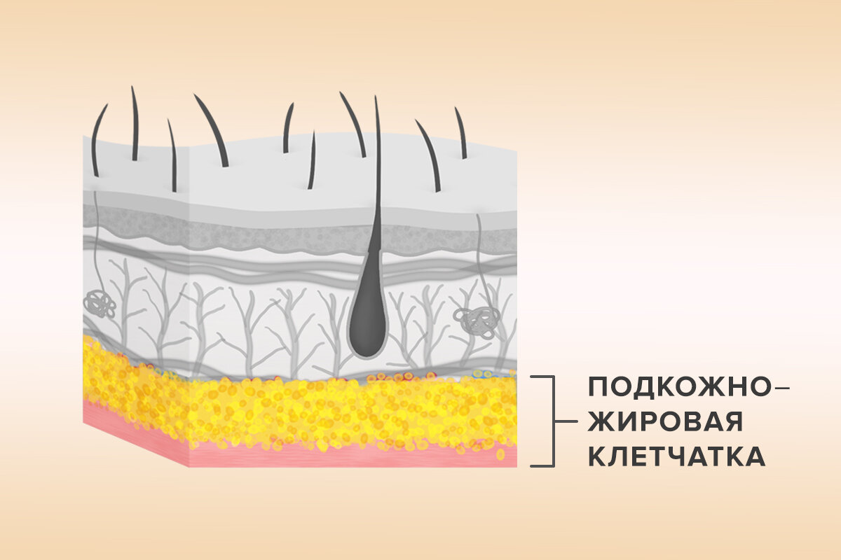 Кожно жировая клетчатка. Кожа истончилась до ПЖК. Видно органы через кожу.