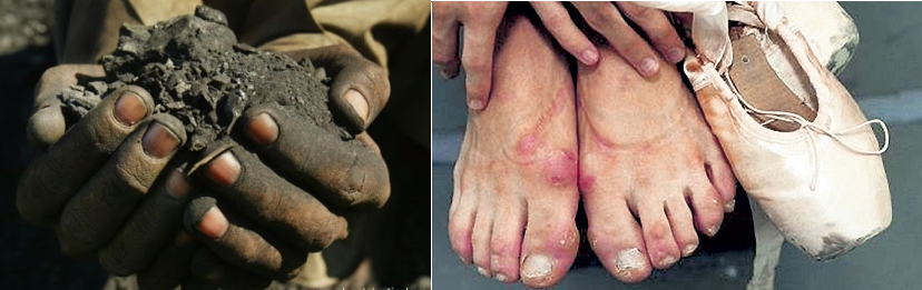 Руки шахтера и ноги балерины. 1:1