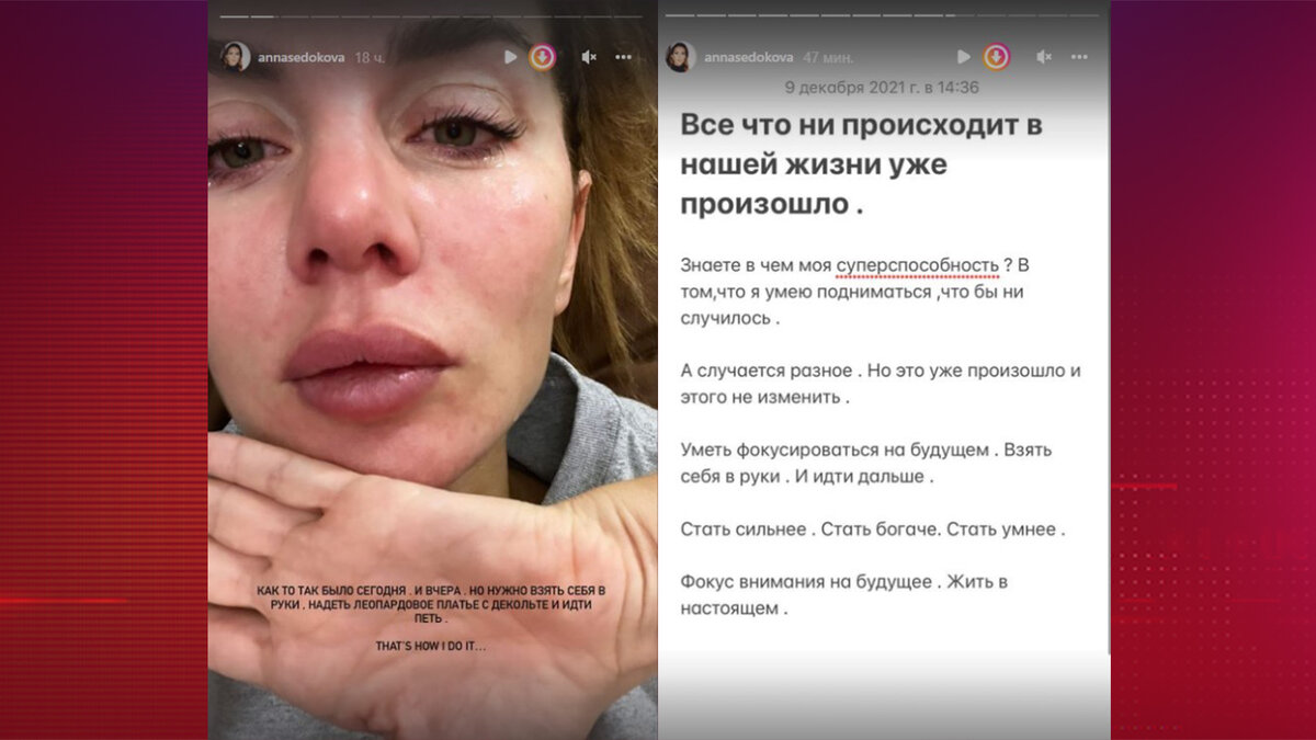 Фото из соц сетей Седаковой