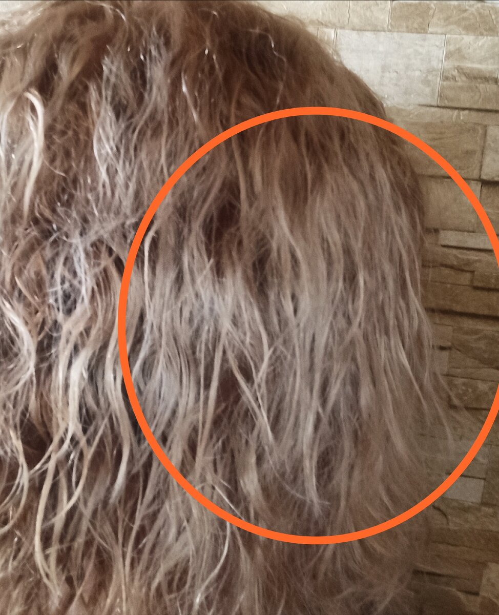 Неприятный запах от волос и головы - Клиника «Доктор Волос»