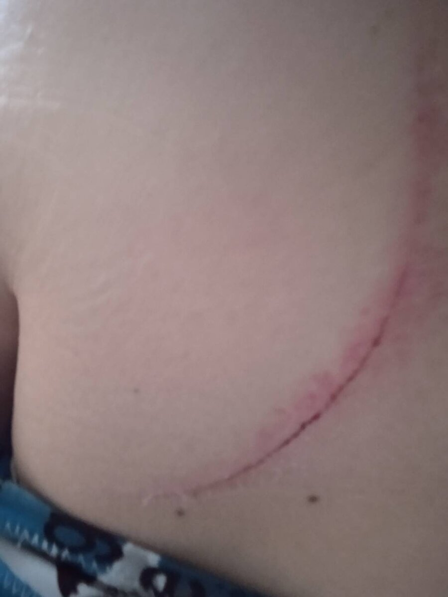 Спустя несколько дней